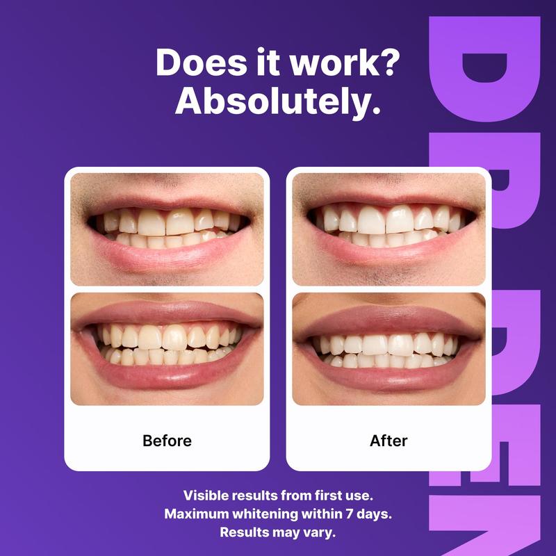 PRIVENIX™ Teeth Whitening Strips – Safe 7 Day Whitening for Sensitive Teeth