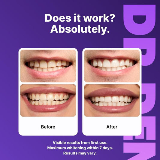 PRIVENIX™ Teeth Whitening Strips – Safe 7 Day Whitening for Sensitive Teeth